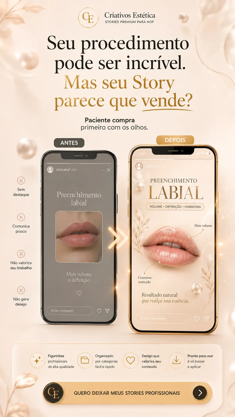 Antes e depois de Story de Preenchimento labial usando o Criativos Estética