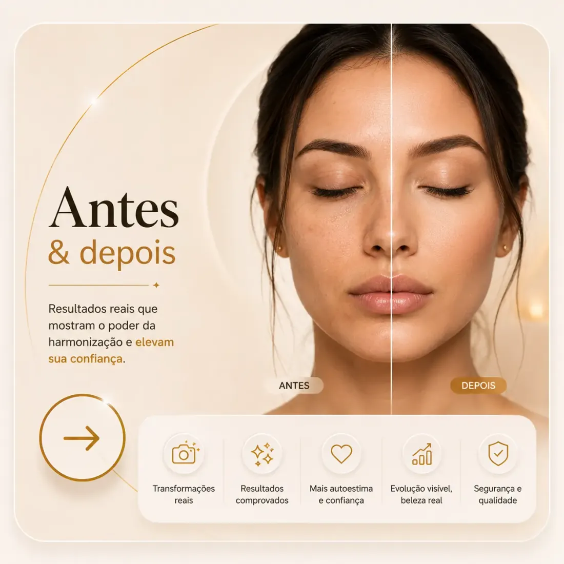 Antes & depois
